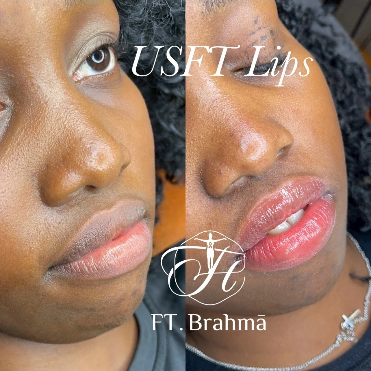 Line Album 唇部養色粉嫩 260124 29