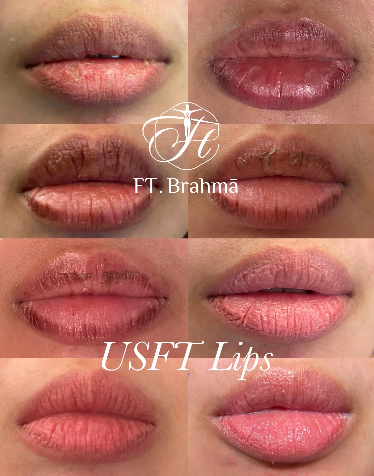 Line Album 唇部養色粉嫩 260124 31