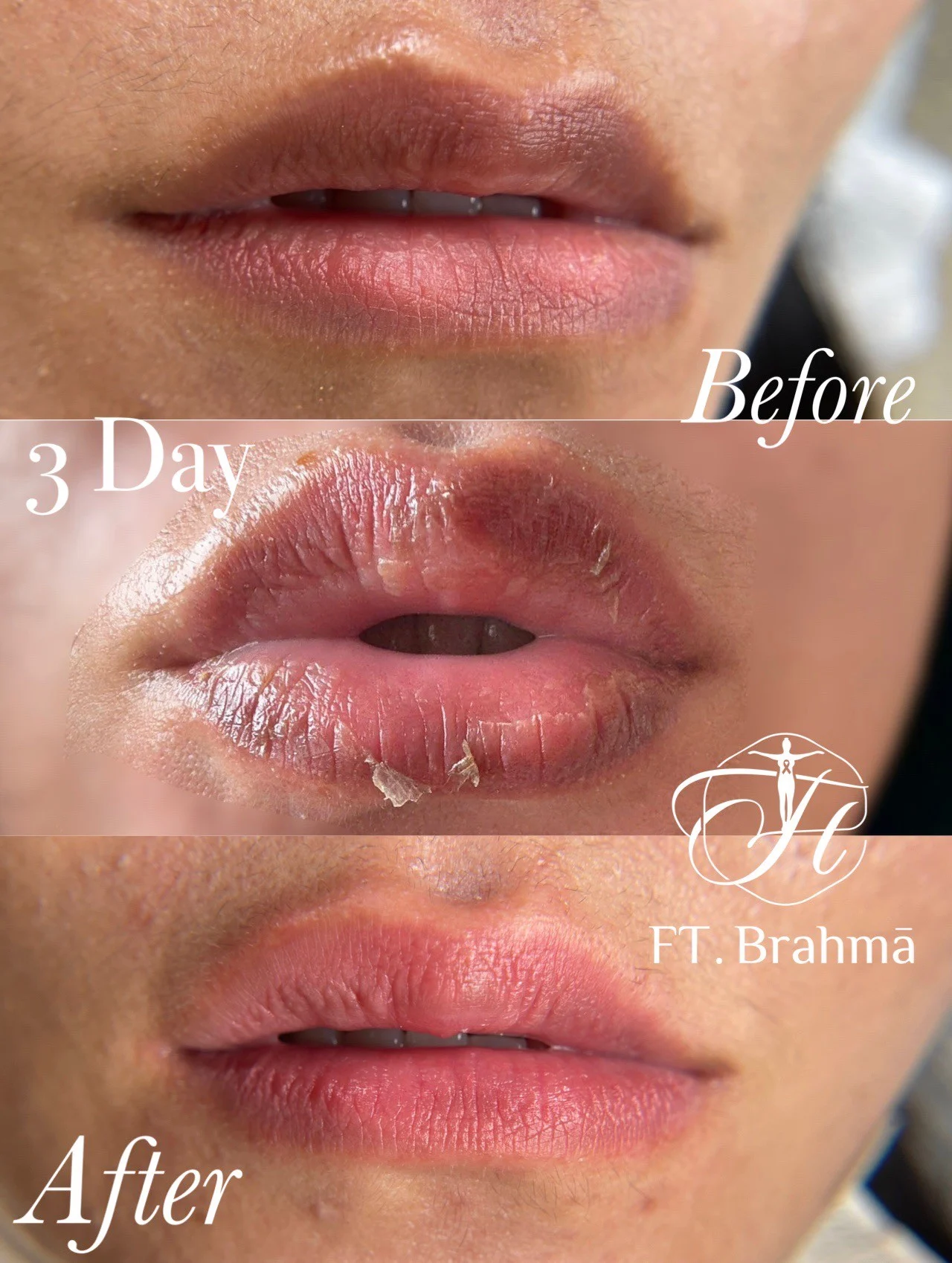 Line Album 唇部養色粉嫩 260124 30